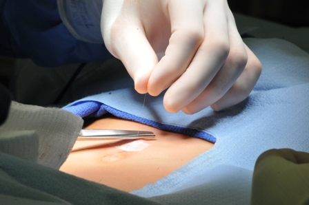 Drape/ Operation drape/ Under Pad